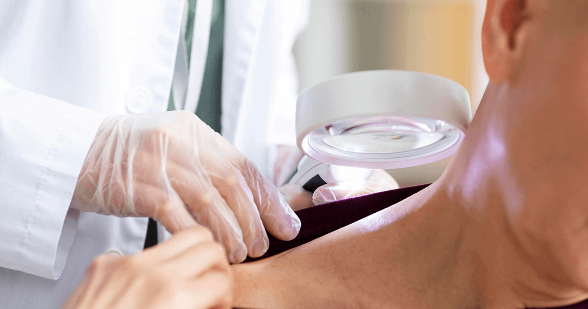 Hautkrankheiten können ein Anzeichen für inneren Krebs sein