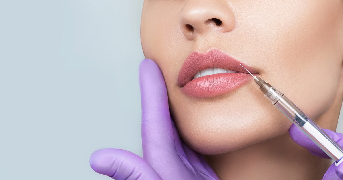 Everything you need to know about lip fillers