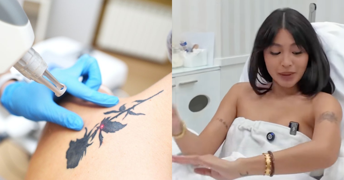 Nadine Lustre is having some of her tattoos removed. Here's what to ...