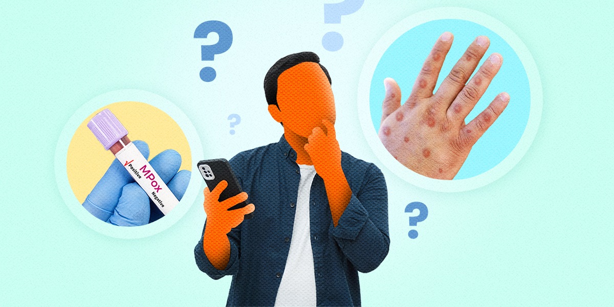 Myths vs. Facts: What is the truth about mpox and how is it actually ...